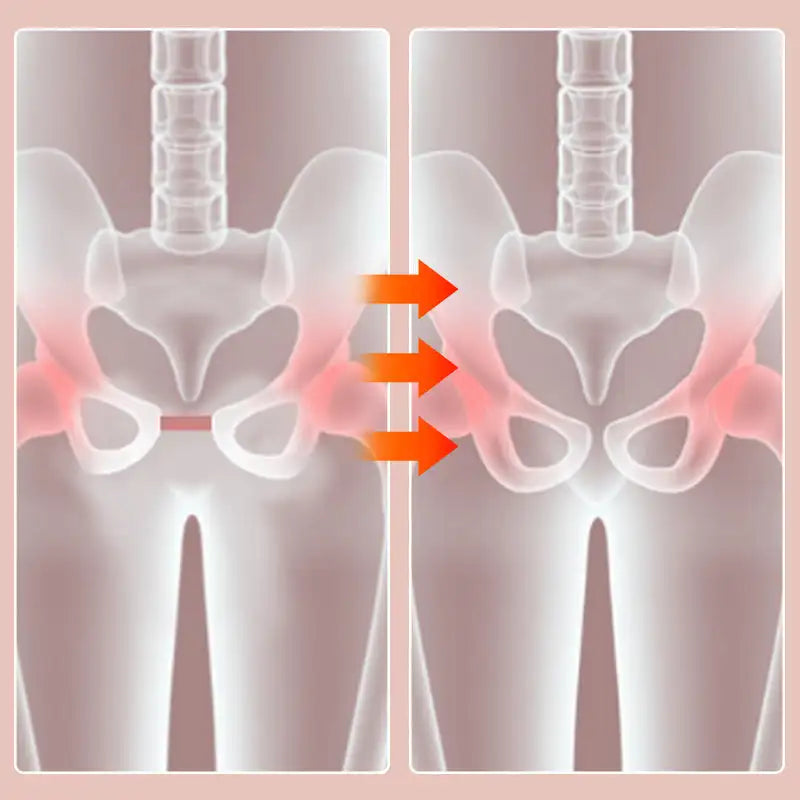 LegCare – Comfort Recovery Trainer